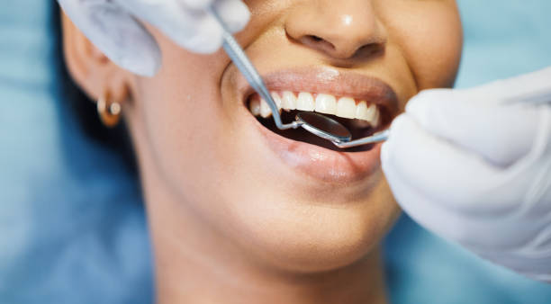 Best Emergency Dental Care for Sports Injuries in Lawrencevle, IL