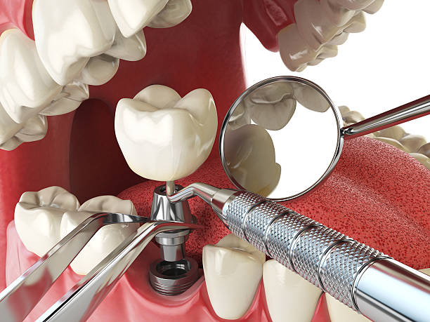 Best 24-Hour Emergency Dental Care in Lawrencevle, IL